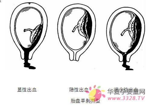 ����̥�P�焃�Y�ԭ��